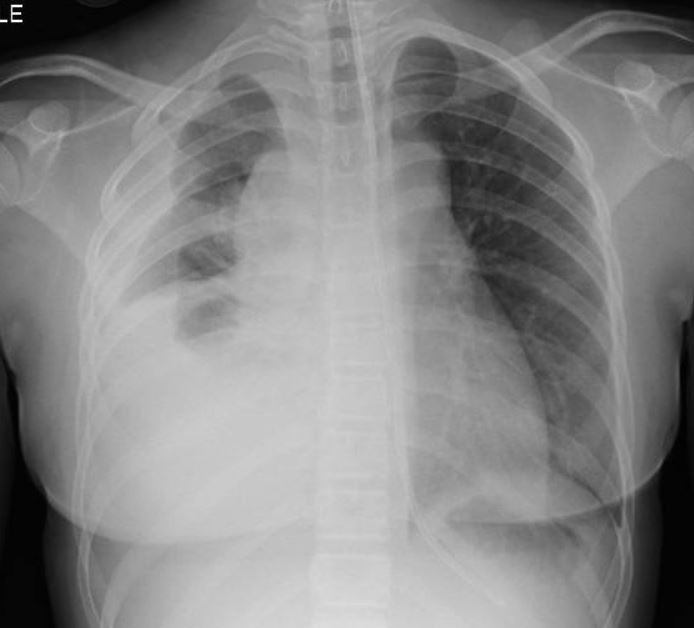Case 10